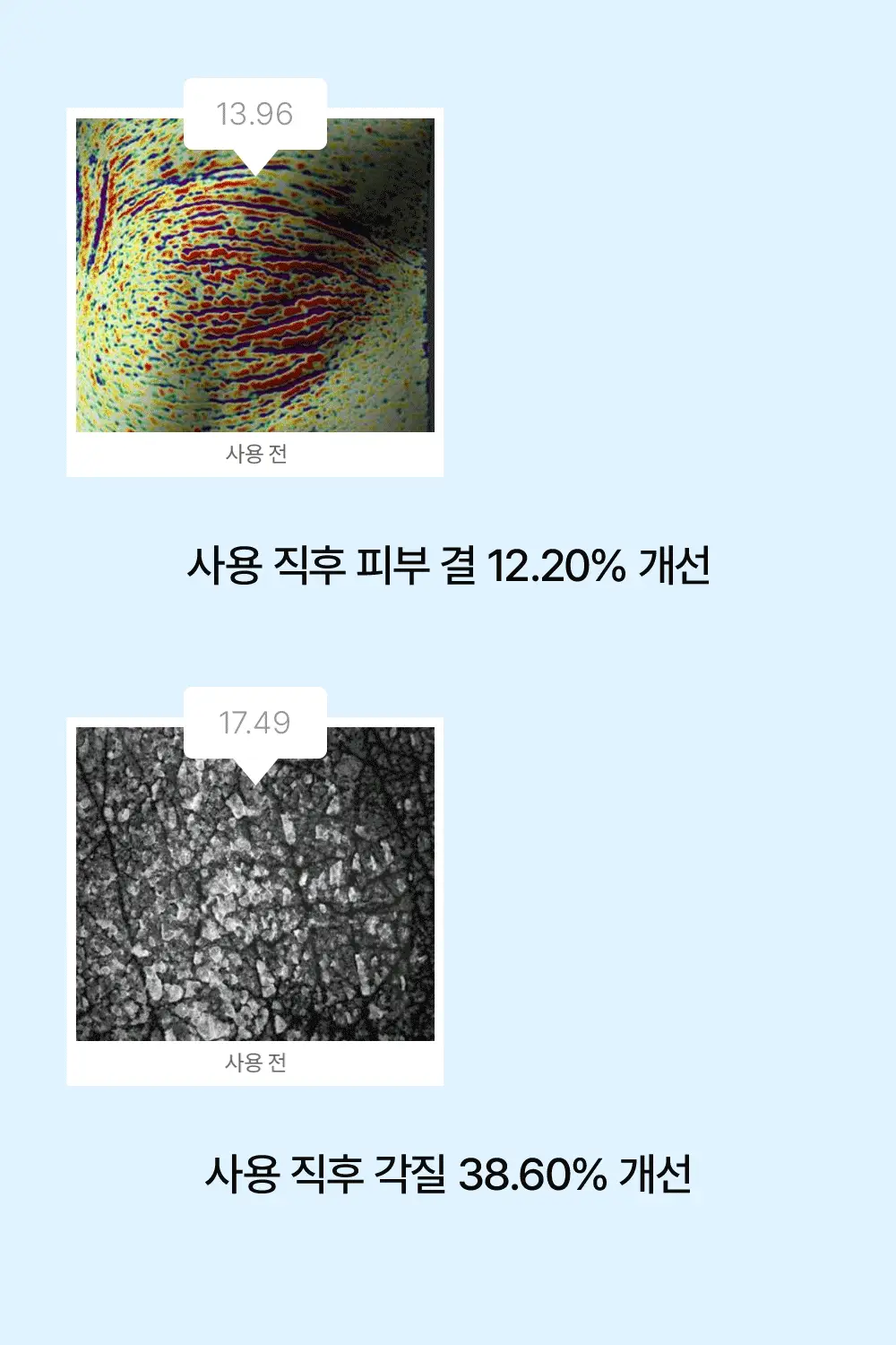 [등드름/가드름] 낫포유 클리어 SOS 바디패드 10매입 상세페이지 22